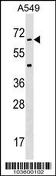 STK35 Antibody (Center)