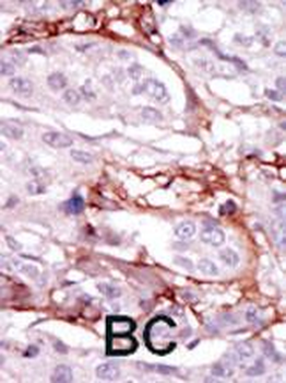STK31 Antibody (N-term)