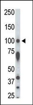 STK31 Antibody (N-term)