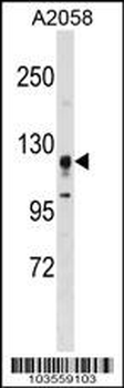 STK31 Antibody (N-term)