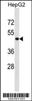 PHKG2 Antibody (Center)