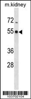 PHKG2 Antibody (Center)