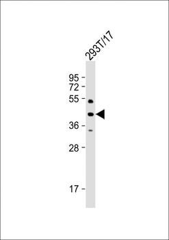 PHKG2 Antibody (Center)