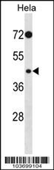 PHKG2 Antibody (N-term)
