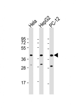 MAPK14 Antibody (Y323)