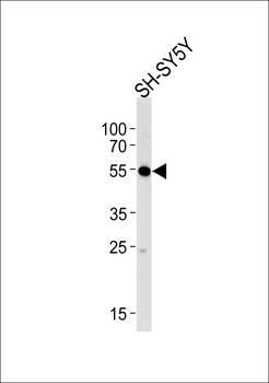 MAPK10 Antibody (N-term)