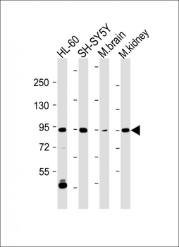 ZPK Antibody (C-term)