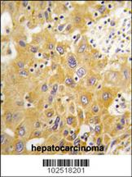 CAMK1D (CAMK1 delta)Antibody (C-term)