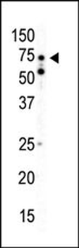 AMPK alpha2 Antibody (C-term)
