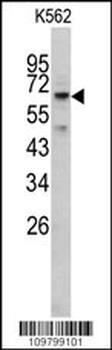 RIOK1 Antibody (N-term)