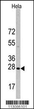 HSP27 (HSPB1) Antibody (S83)