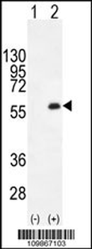 MYT1 (PKMYT1) Antibody (C-term)