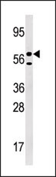 URKL1 Antibody (N-term)