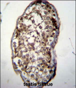 UCK2 Antibody (C-term)