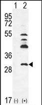 UCK2 Antibody (C-term)
