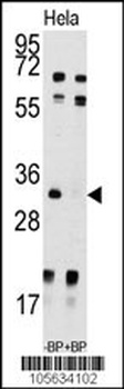 UCK2 Antibody (N-term)