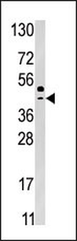 SEPSH2 Antibody (Center)