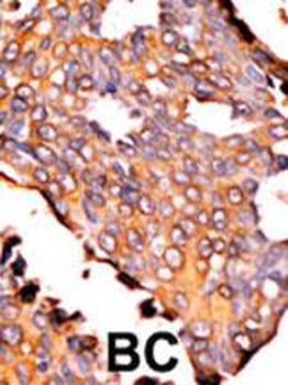 RFK Antibody (N-term)