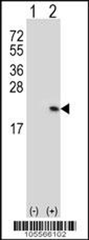 RFK Antibody (N-term)