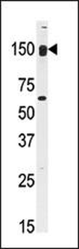 CLASP2 Antibody (C-term)