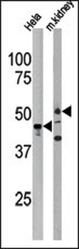 PSKH1 Antibody (N-term H70)