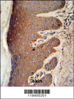 PKM2 Antibody (C-term L398)