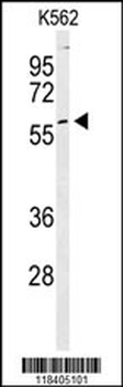 PKM2 Antibody (C-term L398)