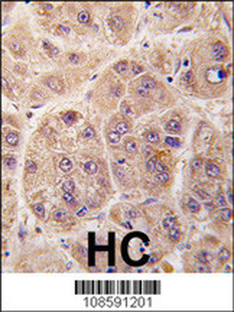 PIM3 Antibody (C-term)