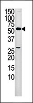 PANK2 Antibody (Center)