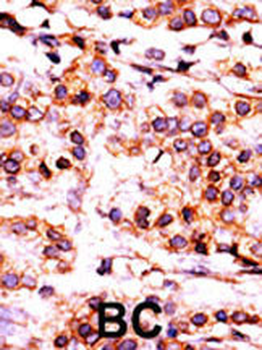 PANK1 Antibody (Center)