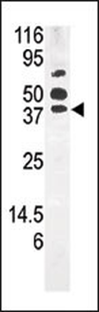 PANK1 Antibody (Center)