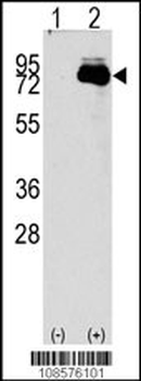 NUAK2 Antibody (N-term)