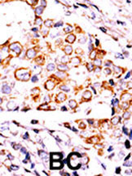 NME3 Antibody (Center)