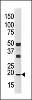 NME3 Antibody (Center)