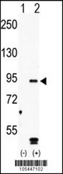 MARK4 Antibody (C-term)