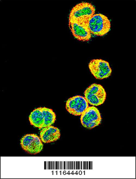 AKT1 Antibody (N-term)