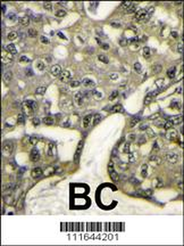 AKT1 Antibody (N-term)