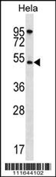 AKT1 Antibody (N-term)