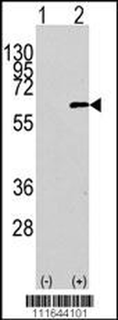AKT1 Antibody (N-term)