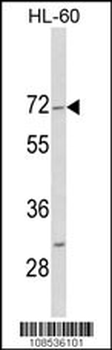 HIPK4 Antibody (C-term)