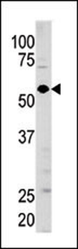Guanylyl Cyclase alpha 1 (GUCY1A3) Antibody (N-term)