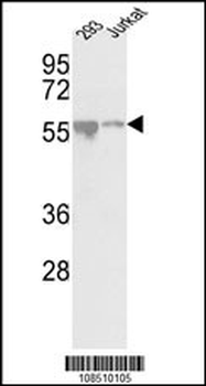 CDKL2 Antibody (Center)
