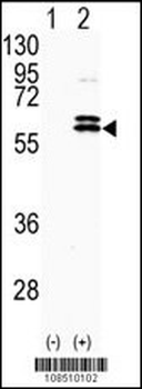 CDKL2 Antibody (Center)