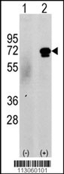 CAMKK2 Antibody (N-term G67)