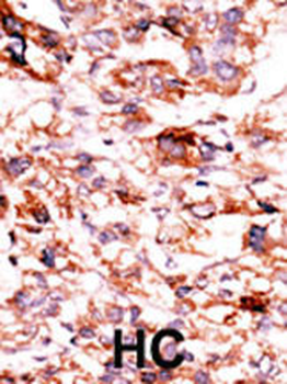 ADCK5 Antibody (C-term)