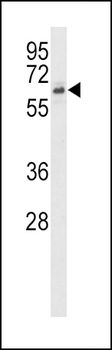 ACVR2B Antibody (N-term)