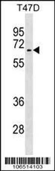 Activin Receptor Type IA (ACVR1) Antibody (Center N99)