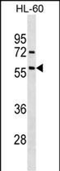 Activin Receptor Type IA (ACVR1) Antibody (Center N153)