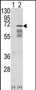 Activin Receptor Type IA (ACVR1) Antibody (Center N153)