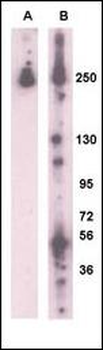 PARK8 (LRRK2) Antibody (L899)
